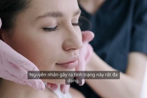 Top 3 Nguyên Nhân Khiến Da Nhạy Cảm Khó Phục Hồi và Giải Pháp